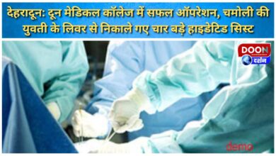 Dehradun Successful operation at Doon Medical College, four large hydatid cysts removed from the liver of a Chamoli girl