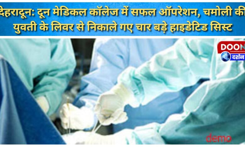 Dehradun Successful operation at Doon Medical College, four large hydatid cysts removed from the liver of a Chamoli girl