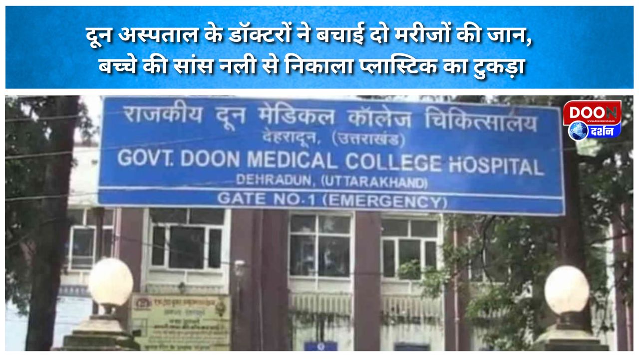 दून अस्पताल के डॉक्टरों ने बचाई दो मरीजों की जान, बच्चे की सांस नली से निकाला प्लास्टिक का टुकड़ा